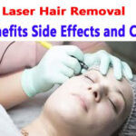 Laser Hair Removal Benefits Side Effects and Cost