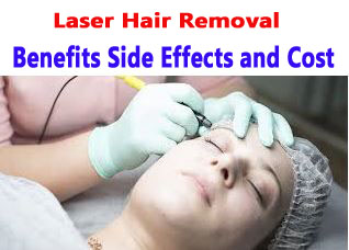 Laser Hair Removal Benefits Side Effects and Cost